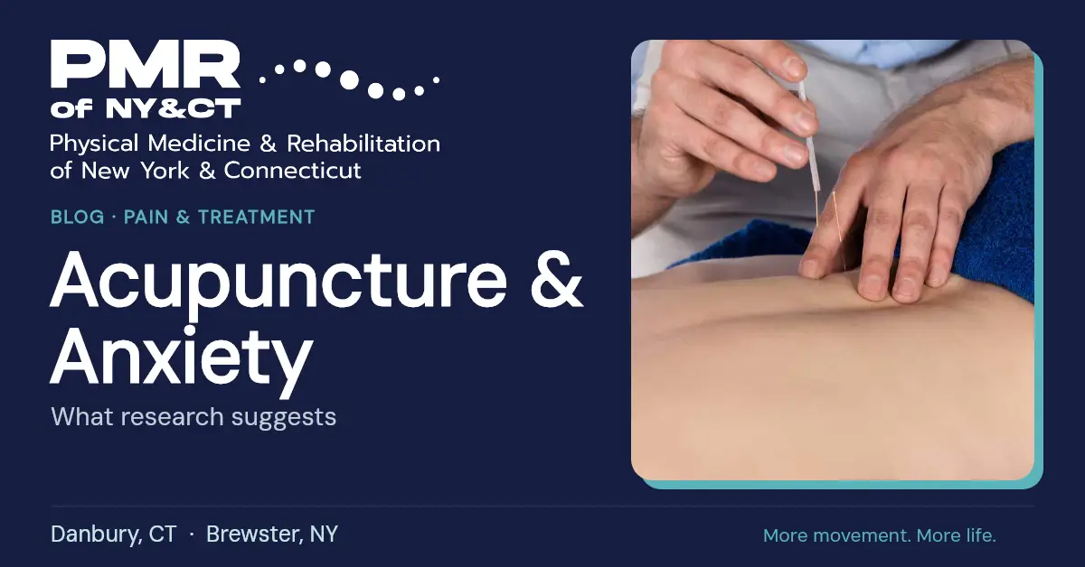 Acupuncture for Anxiety: Can It Help You Feel Calmer?